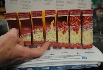 Prof. Kay Doyle points out plaque build up and ruptures in a model that shows the inside of a blood vessel.