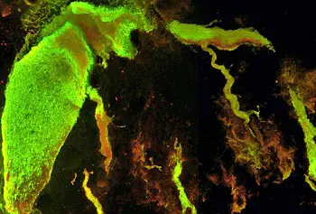 This confocal microscope image of a giant neuron in the brain of a lamprey shows the neuron expressing and secreting human tau protein (the reddish tendrils). Biology Prof. Garth Hall says that tau secretion occurs not only in a biological model system like this lamprey in the lab, but also in the cerebrospinal fluid (CSF) of Alzheimer&rsquo;s disease patients &mdash; that is, the neurons don&rsquo;t have to die first to release tau to the CSF, as has long been believed.