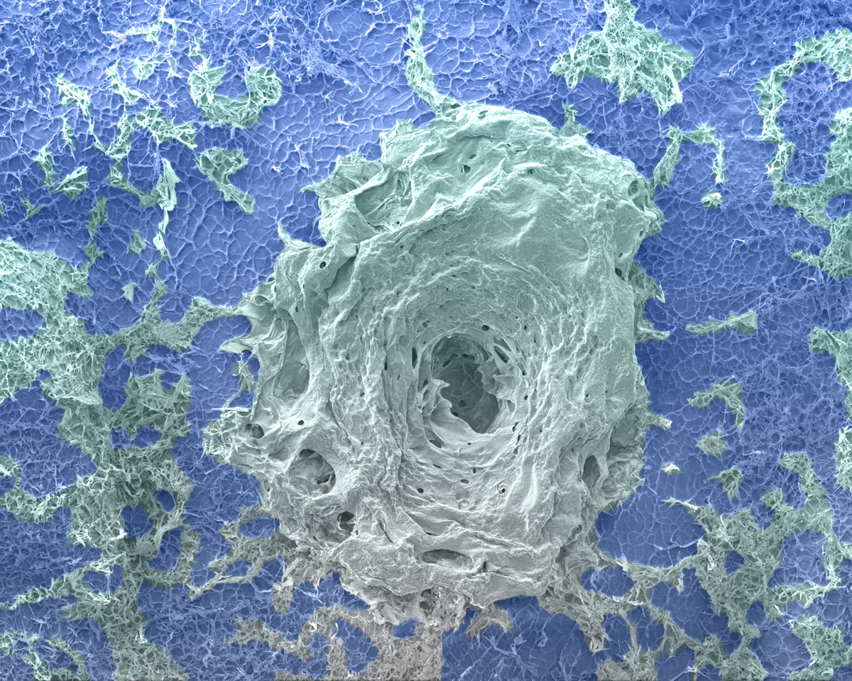 swirled image on blue background