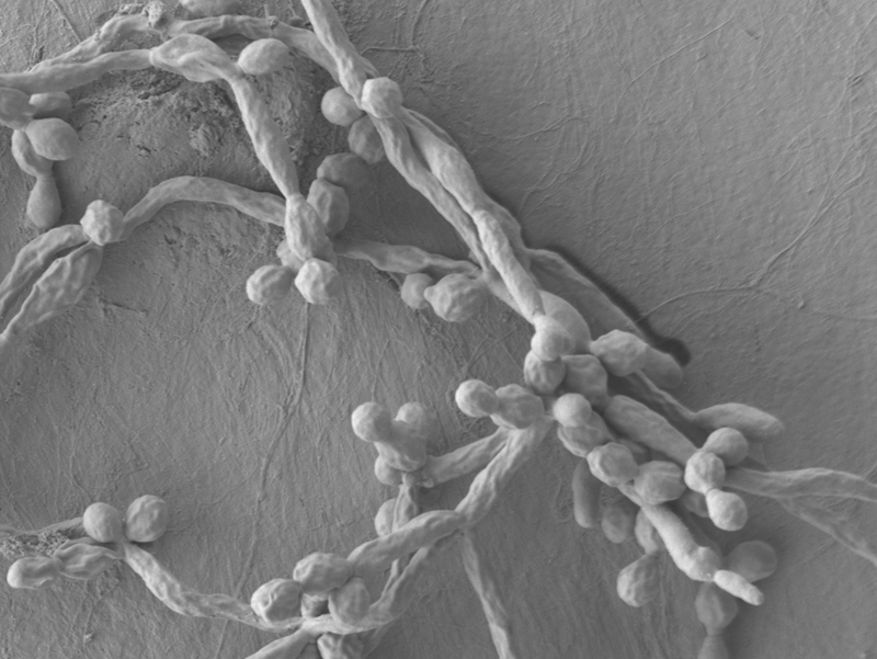 black and white image of rope-like structure