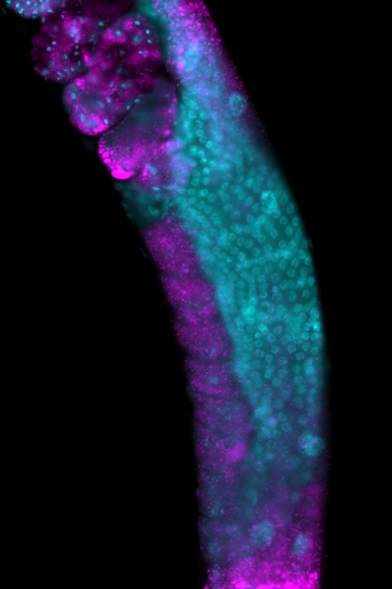 Nematode C. elegans_fluorescent