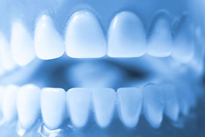 Stock photo of dentures