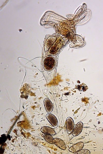Microscope view of a female Octotrocha rotifer