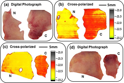 The panel shows optical photographs (a) and (d) and cross-polarized terahertz reflection images (b) and (c) of fresh normal (N) versus cancerous (C) tissues from a human colon.