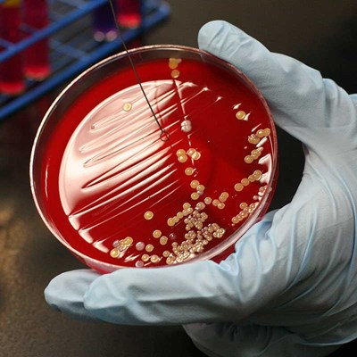 Gloved hand holding a petri dish containing a red substance 