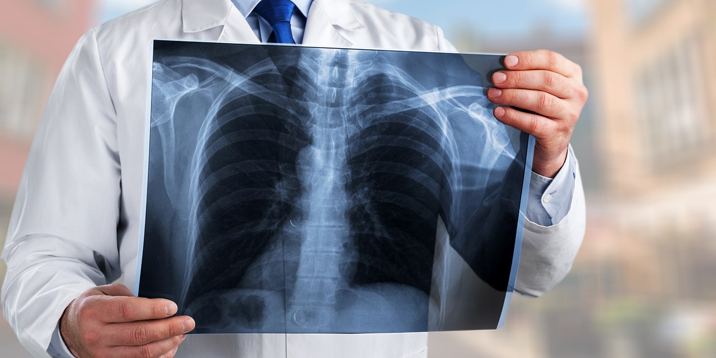 A doctor examines a chest x-ray.